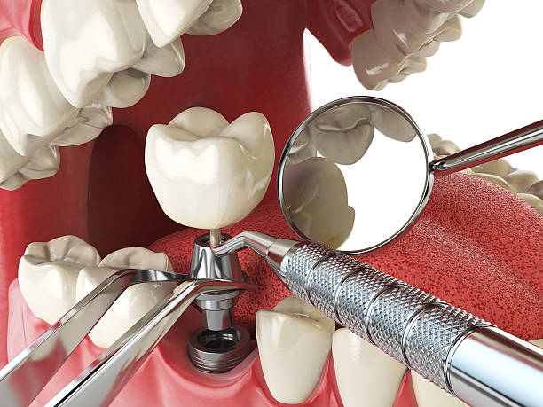 Best Walk-In Emergency Dental Services in Wendell, NC